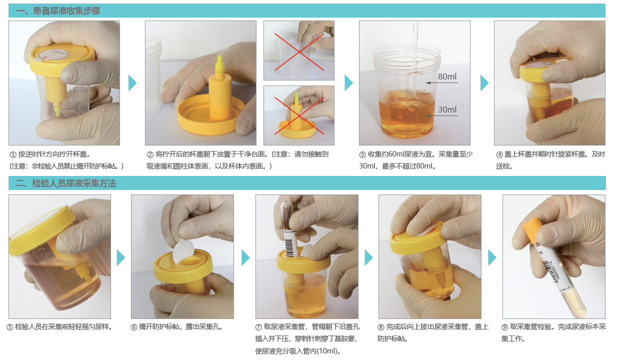 尿液标本采集器 100ml